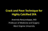 Case #2: Crack and Pave Technique for a Highly Calcified SFA