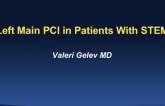 Left Main PCI in Patients With STEMI