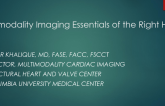 Multi-modality Imaging Essentials of the Tricuspid Valve and Right Heart (Echo and CT)