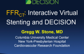 FFRCT: Interactive Virtual Stenting and DECISION