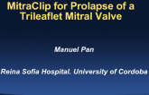 Case #3: MitraClip for Prolapse of a Trileaflet Mitral Valve
