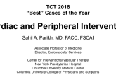My Best Case – Combined Coronary and Peripheral Intervention