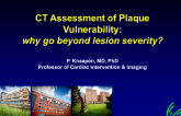 The Vulnerable Plaque and Patient Revisited: Whole-Heart Quantitation and Characterization of Atherosclerosis by CT