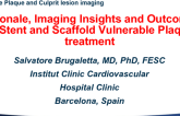 Rationale, Imaging Insights and Outcomes of Stent and Scaffold Vulnerable Plaque Treatment
