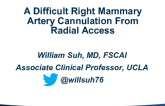 Case #9: A Difficult Right Mammary Artery Cannulation From Radial Access
