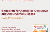 Case Presentation: Endograft for Aortoiliac Occlusive and Aneurysmal Disease