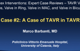 Case #2: A Case of TAVR in TAVR