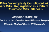 Case #4: Mitral Valvuloplasty Complicated by Severe Mitral Regurgitation in a Patient With Rheumatic Mitral Stenosis