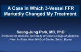 Case #2: A Case in Which 3-Vessel FFR Markedly Changed My Treatment