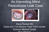Case #4: A Complex Mitral Paravalvular Leak