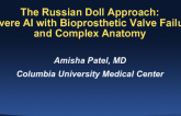 #6 The Russian Doll Approach… Severe AS/AR With Bioprosthetic Valve Failure and “Complex” Anatomy - Case Presentation
