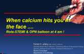 Case #7: When Calcium Hits You in The Face - Rota-STEMI and OPN Balloon at 4 AM!