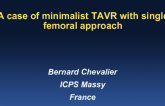 Case #4: A Case of Minimalist TAVR With Single Femoral Access