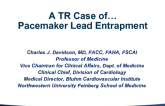 Case Presentation: A TR Case of… Pacemaker Lead Entrapment