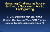 Managing Challenging Access to Ensure Successful Aortic Endografting