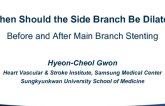When Should the Side Branch Be Dilated (Before and After Main Branch Stenting)