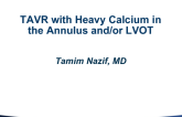 #3 Calcium, Calcium and more Calcium…Severe AS with Heavily Calcified Annulus/LVOT - Case Presentation
