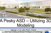Case #5: A Pesky ASD, With Help From Modelling