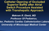 Case #9: Catheter Opening of Occluded Superior Baffle After Atrial Switch With Assisted Transhepatic Approach