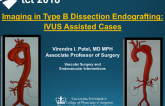 Imaging in Type B Dissection Endografting: IVUS Assisted Techniques (With Case Examples)