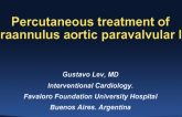 Case 1 From Argentina: Complex Paravalvular Leak Closure