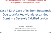 Case #12: A Case of In-Stent Restenosis Due to a Markedly Under-expanded Stent in a Severely Calcified Lesion