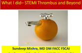 STEMI Presentation: Thrombus and Beyond - Case Conclusion