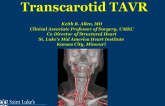 Case #6: Trans-Carotid TAVR Step-by-Step