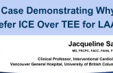 Case #4: A Case Demonstrating Why I Prefer ICE Over TEE for LAA Occlusion