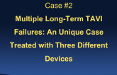 Case #2: Multiple Long-term TAVI Failures: A Unique Case Treated With Three Different Devices