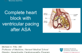 Case #3: Third-Degree AV Block After Ablation Requiring Upgrade from VVI to Dual Chamber Pacing