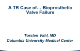 Case Presentation: A TR Case of… Bioprosthetic Valve Failure
