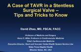 Case #5: A Case of TAVR in a Stentless Surgical Valve – Tips and Tricks to Know