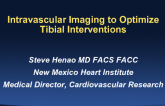 Intravascular Imaging to Optimize Tibial Interventions