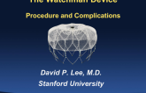 Overview of the Watchman Procedure and Complications
