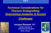 France Presents: Our Most Common Approach to Aortic Dissection
