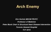 Case #10: An Arch Complication After Aortic Coarctation Stenting