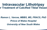 Intravascular Lithotripsy for Treatment of Calcified Tibial Vessels