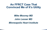 Case #1: An FFRCT Case That Convinced Me of It's Utility