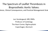 The Spectrum of Leaflet Thrombosis in Bioprosthetic Aortic Valves - Prevalence, Clinical Consequences, and Practical Management Strategies
