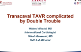 Case 6 From Saudi Arabia: Transcaval TAVR Complicated by Double Trouble