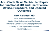 AccuCinch Basal Ventriculoplasty for Functional MR and Heart Failure: Device, Procedure, and Updated Outcomes