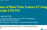 Case #6: A Case of Real-Time Fusion CT Imaging to Guide CTO PCI