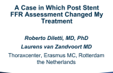 Case #4: A Case in Which Post-Stent FFR Assessment Changed My Treatment