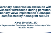 First Place Winner Case Title: Coronary Compression Exclusion With Intravascular Ultrasound During Percutaneous Pulmonary Valve Implantation Subsequently Complicated By Homograft Rupture