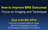 How to Improve BRS Outcomes: Focus on Imaging and Technique