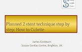 Planned 2-Stent Technique Step-by-Step: How to Culotte