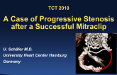 Case #1: A Case of Progressive Stenosis After a Successful MitraClip