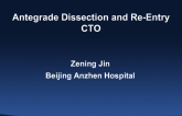Case #2: Antegrade Dissection and Re-Entry CTO