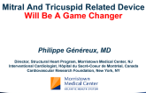 MR and TR Valve Related Device Will be a Game Changer? -From US Academia's Prospective